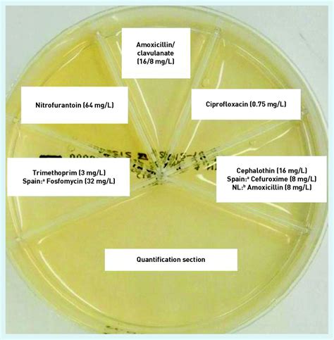 Urine Culture .